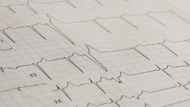 循環器内科と異常心電図